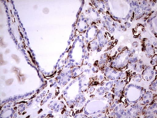 Vimentin Antibody (aa210-466, clone UMAB159)