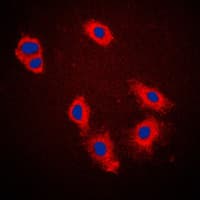 Polyclonal Rabbit anti-Human CASP9 / Caspase 9 Antibody (Internal, IHC, IF, WB)
