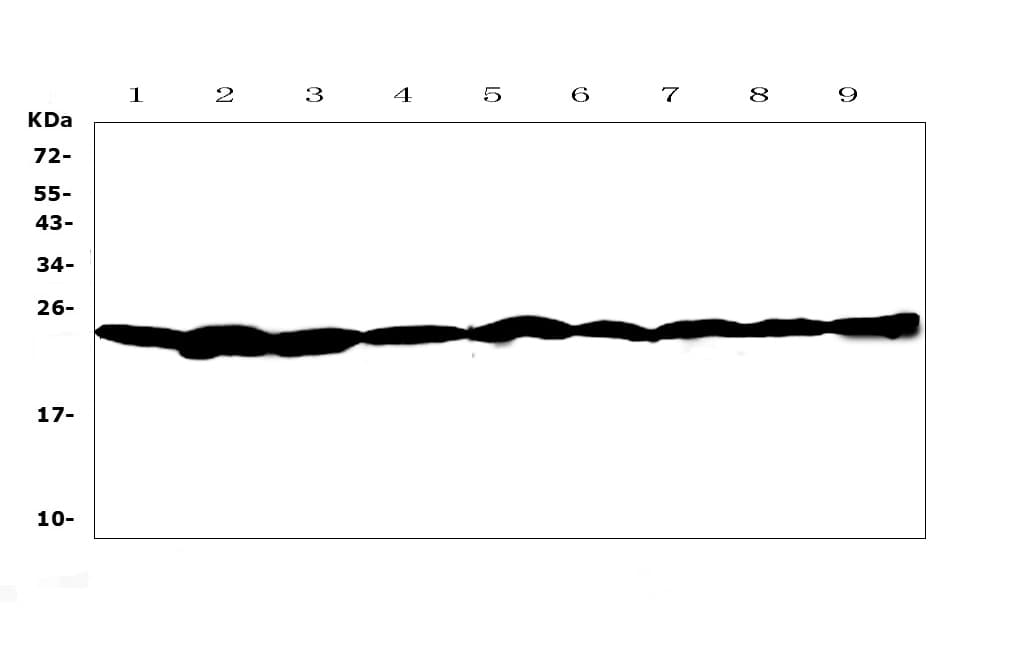 RAN Antibody