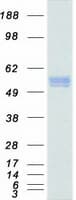 Human SQSTM1 Protein (Recombinant Myc-DDK (Flag))