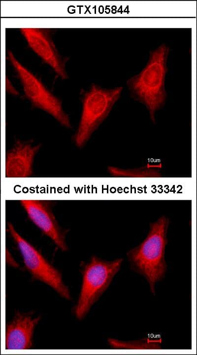 PROC / Protein C Antibody