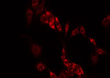 RAB33A Antibody