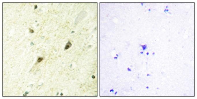 Polyclonal Rabbit anti-Human GLI3 Antibody (IHC, IF)