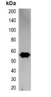 RFP Tag Antibody