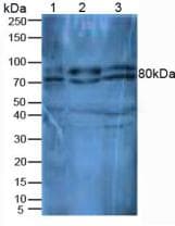 DPP4 / CD26 Antibody (aa631-760)