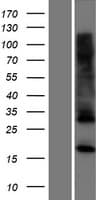 C17orf62 Protein (Over-Expression Lysate Myc-DDK (Flag))
