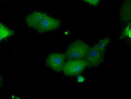 PIM2 / Pim-2 Antibody (clone OTI9A5)