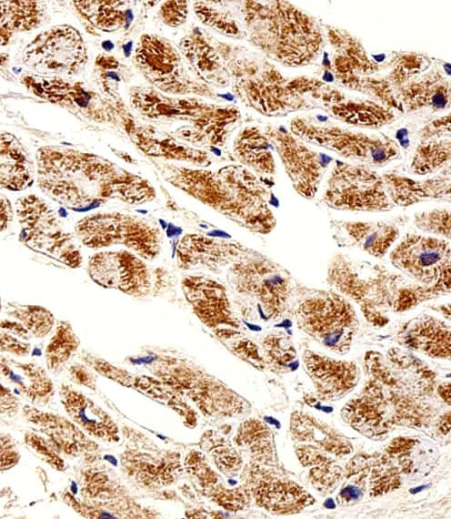 ZNF175 Antibody (aa150-187)