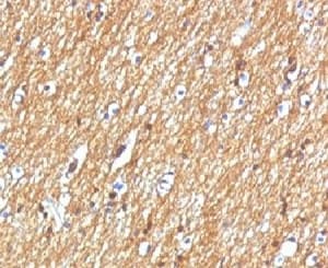 NCAM / CD56 Antibody (clone NCAM1/795)