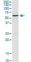 Monoclonal Mouse anti-Human CACNB4 Antibody (clone 7E1, WB)