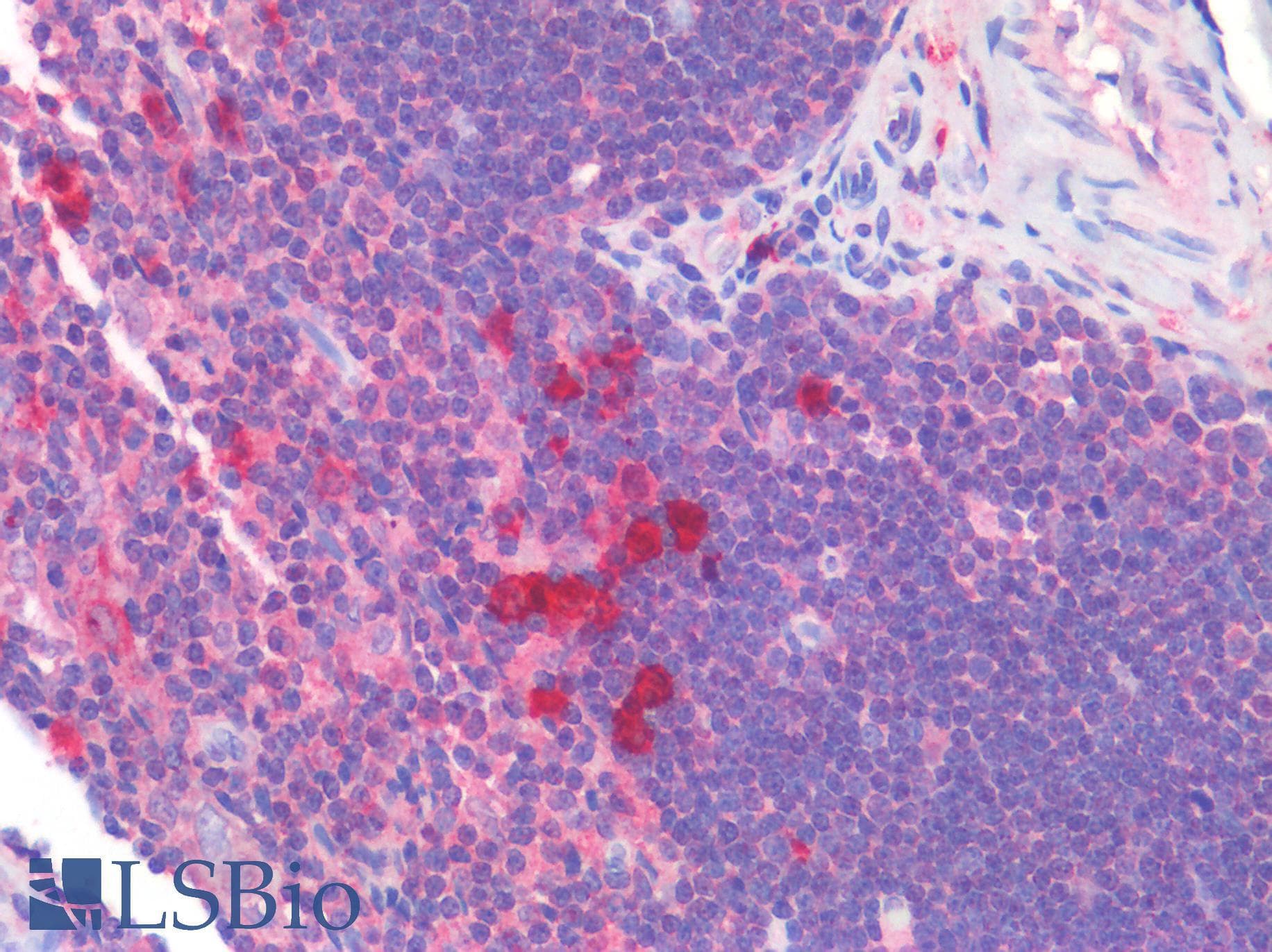PathPlus™ BTLA / CD272 Antibody