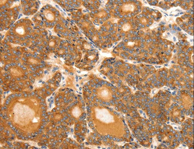 Polyclonal Rabbit anti-Human Secretin Antibody (IHC)