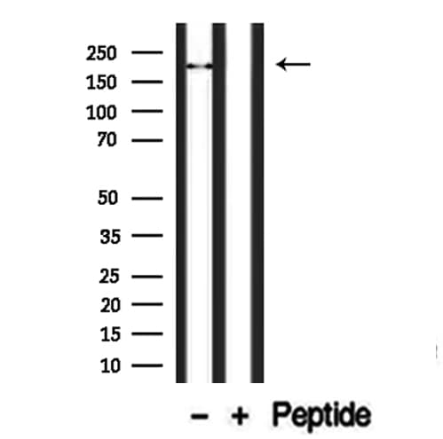 TRPM2 Antibody