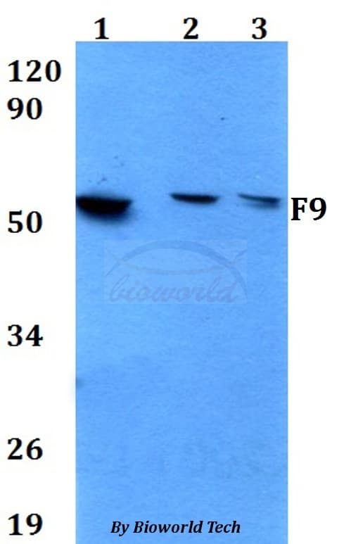 F9 / Factor IX Antibody
