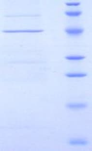 Rat CD40L Protein (Recombinant His-GST)