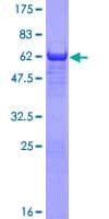 Human GYG1 / Glycogenin Protein (Recombinant GST)