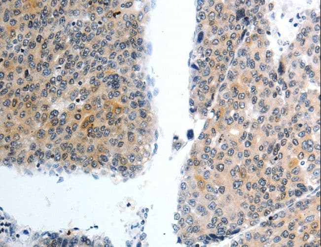 SLC22A3 / OCT3 Antibody