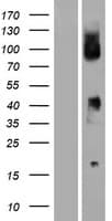 FCGR1B Protein (Over-Expression Lysate Myc-DDK (Flag))