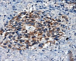 SRR / Serine Racemase Antibody (clone OTI1D7)