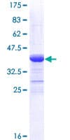 Human TGFBR2 Protein (Recombinant GST, N-terminus)