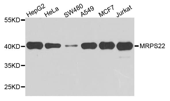 Polyclonal Rabbit anti-Human MRPS22 Antibody (IHC, WB)
