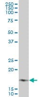 NDUFB7 / B18 Antibody (clone 4D4)