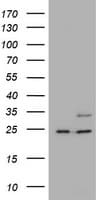 RAB21 Antibody (clone OTI6H8)