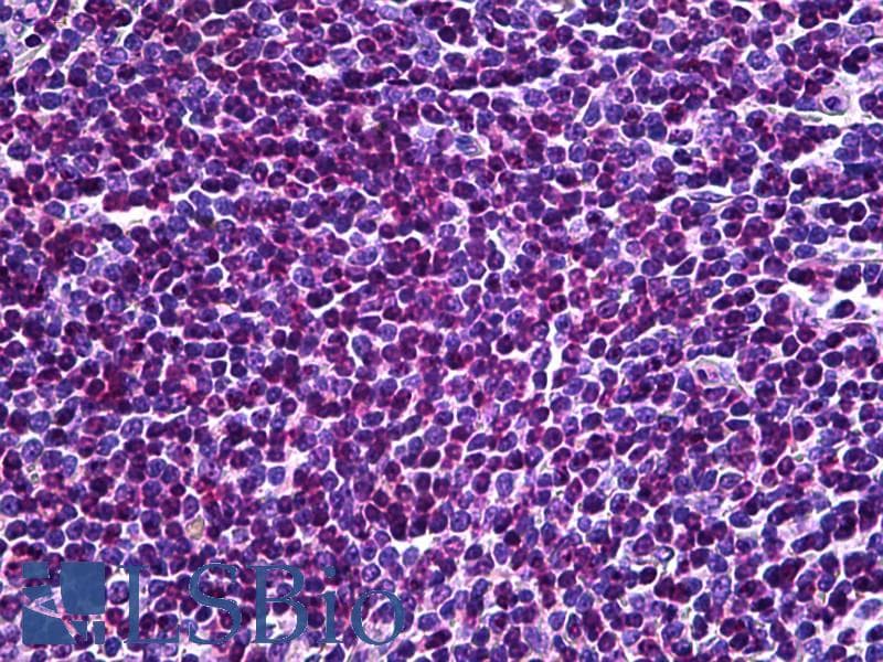 IHC-plus™ Polyclonal Goat anti-Human UBR5 Antibody (aa69-79, IHC)
