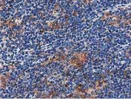 Monoclonal Mouse anti-Human SQSTM1 Antibody (clone OTI4E2, IHC, IF, WB)