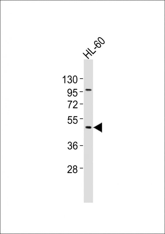 Polyclonal Rabbit anti-Human CHST12 Antibody (aa72-106, WB)