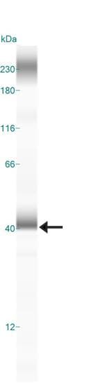 LAMP2 / CD107b Antibody (clone H4B4)