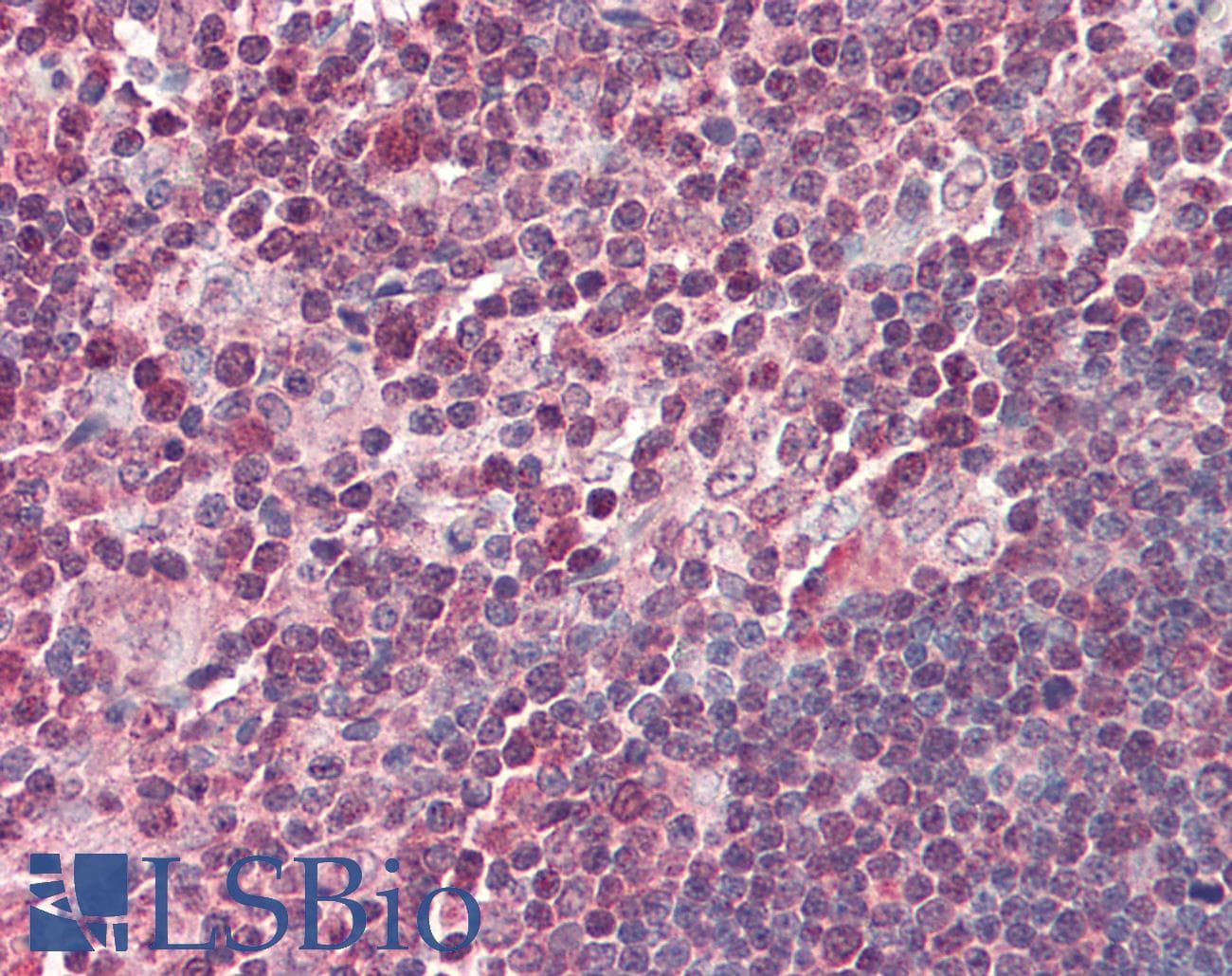 IHC-plus™ NFKB2 Antibody (C-Terminus)