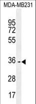 OR10Z1 Antibody (aa284-313)