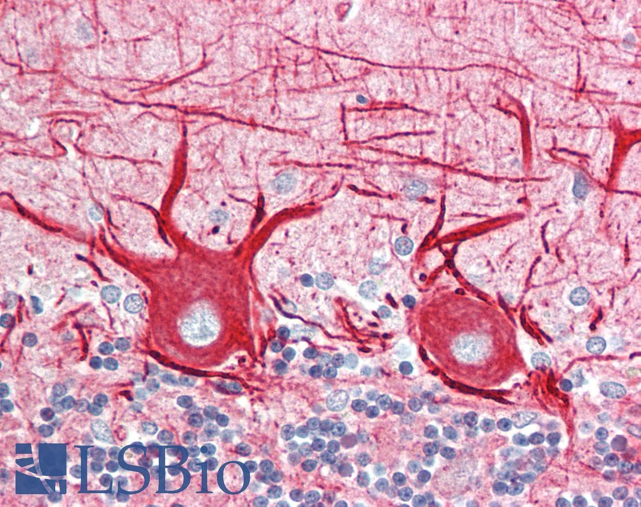 IHC-plus™ Polyclonal Chicken anti-Human INA / Alpha Internexin Antibody (IHC, IF, WB)
