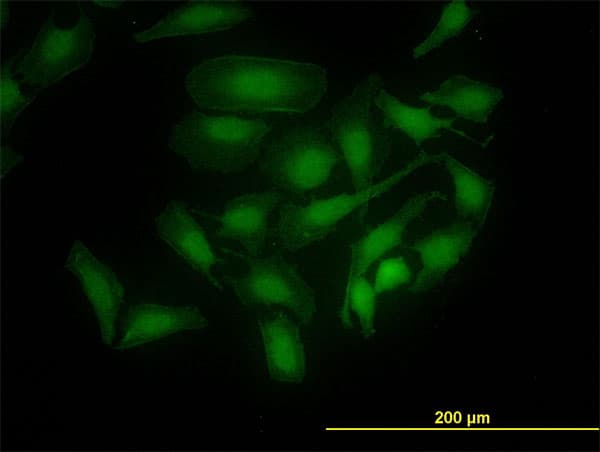 PBK / TOPK Antibody (clone 3A11)