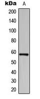 BAIAP2L1 Antibody (Internal)