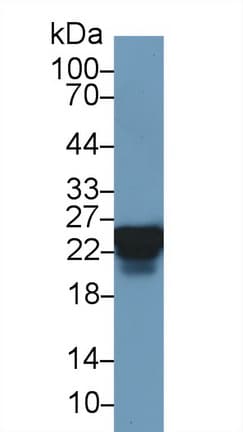 HSPB1 / HSP27 Antibody (aa2-205, APC)