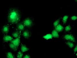 Complement C1s Antibody (clone OTI4E3)