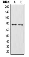 MMP9 / Gelatinase B Antibody (C-Terminus)