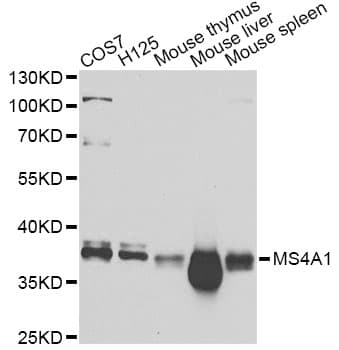 CD20 Antibody