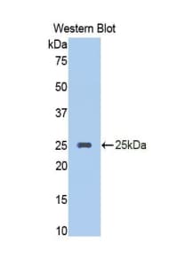 SERPINA10 / PZI Antibody (aa278-425)