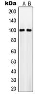 SLC4A11 / NABC1 Antibody (Internal)