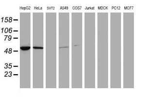 EPHX1 / Epoxide Hydrolase 1 Antibody (clone OTI3A10)