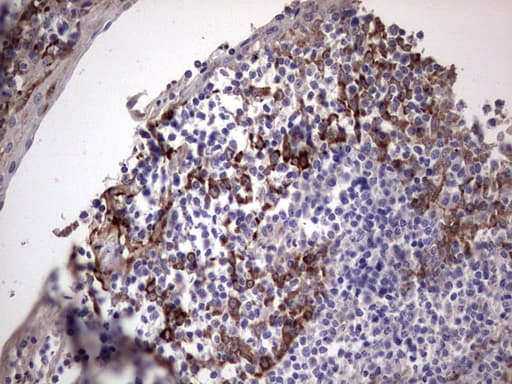 LAMB3 / Laminin Beta 3 Antibody (aa424-773, clone OTI3A2)