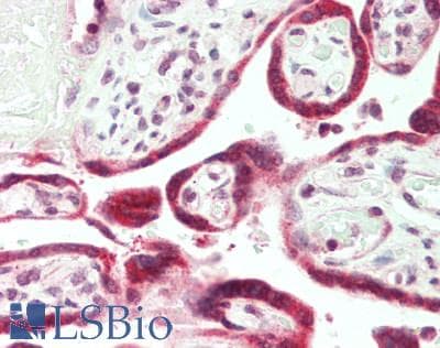PAPPA / PAPP-A Antibody