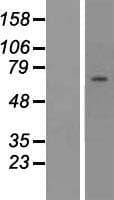 ZNF285 / ZNF285A Protein (Over-Expression Lysate Myc-DDK (Flag))