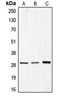 Polyclonal Rabbit anti-Human CDCA3 Antibody (C-Terminus, IHC, IF, WB)
