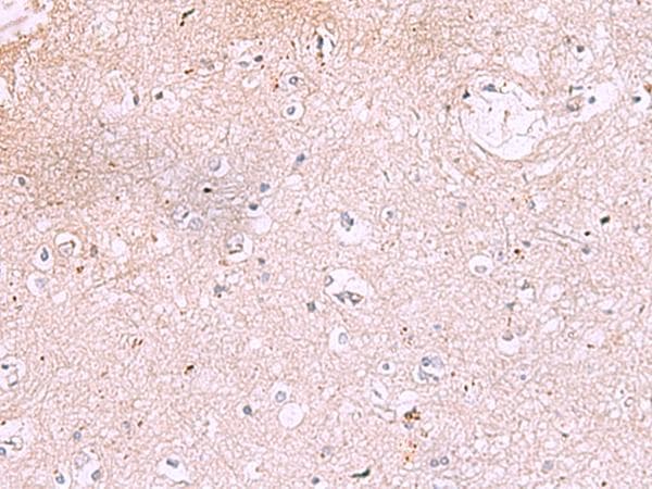 IRX2 Antibody
