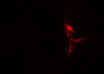 Polyclonal Rabbit anti-Human KRT17 / CK17 / Cytokeratin 17 Antibody (IHC, IF, WB)