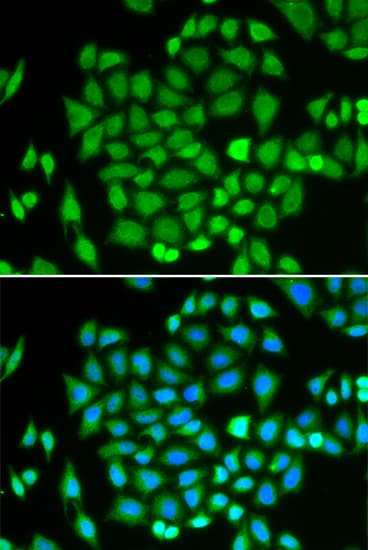 AKR7A2 / AFAR Antibody